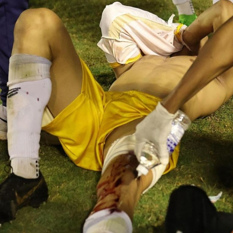 Nota de Repúdio, em acontecimento ao goleiro Ramon Souza